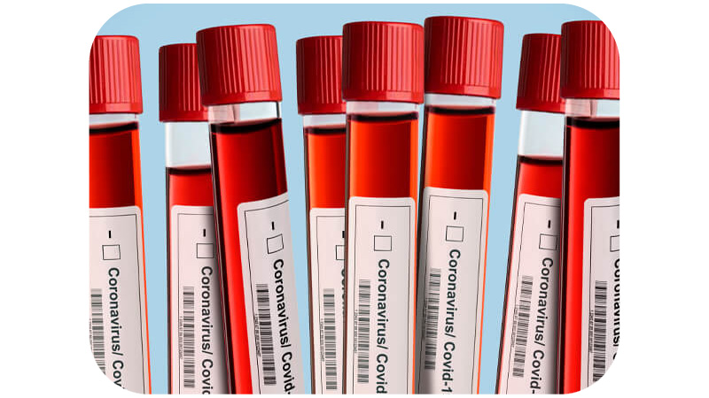 Test tubes